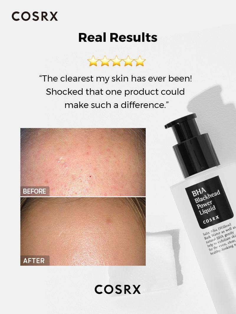 [COSRX] BHA Blackhead Power Liquid Toner 100ml - Bilde 2