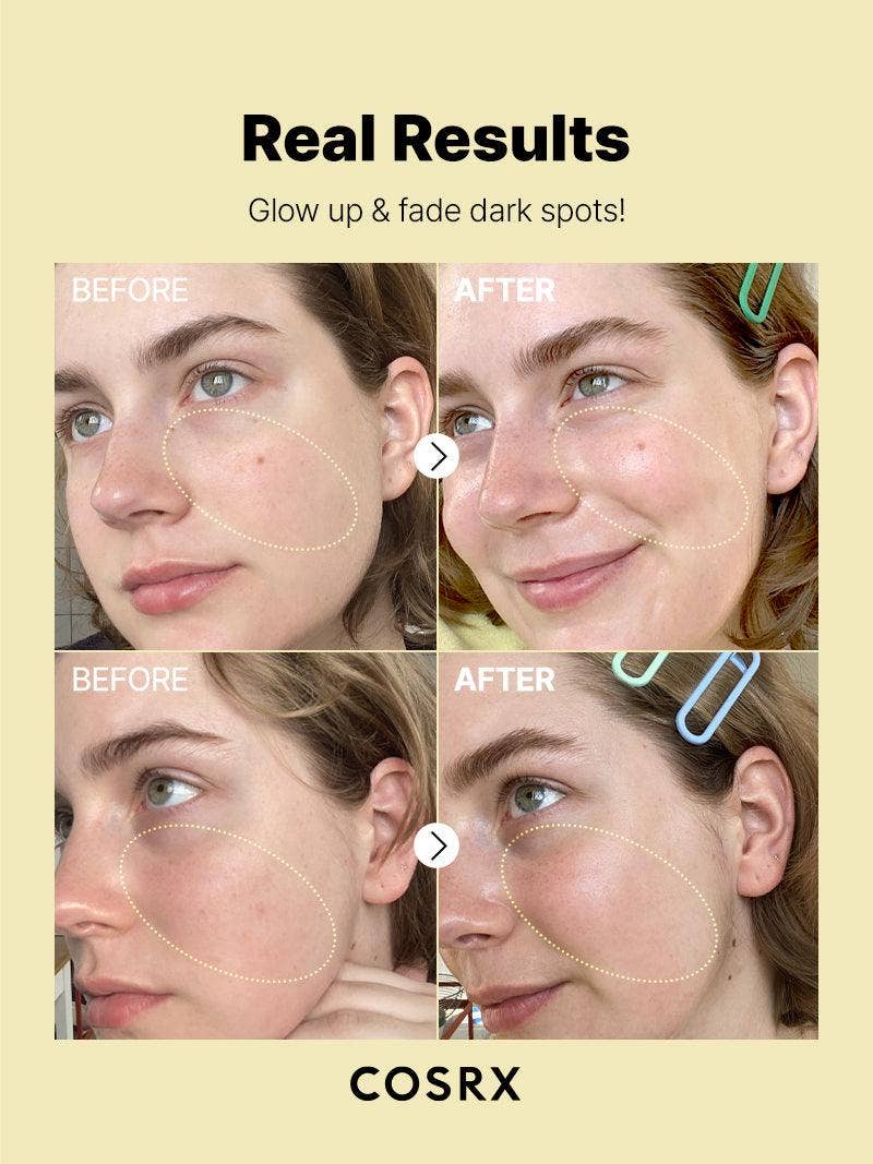 [COSRX] THE VITAMIN C 23 SERUM 20ML - Bilde 2